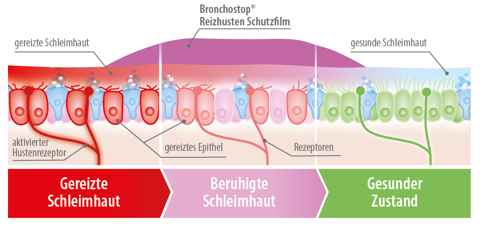 Reizhusten - Gereizte Schleimhaut